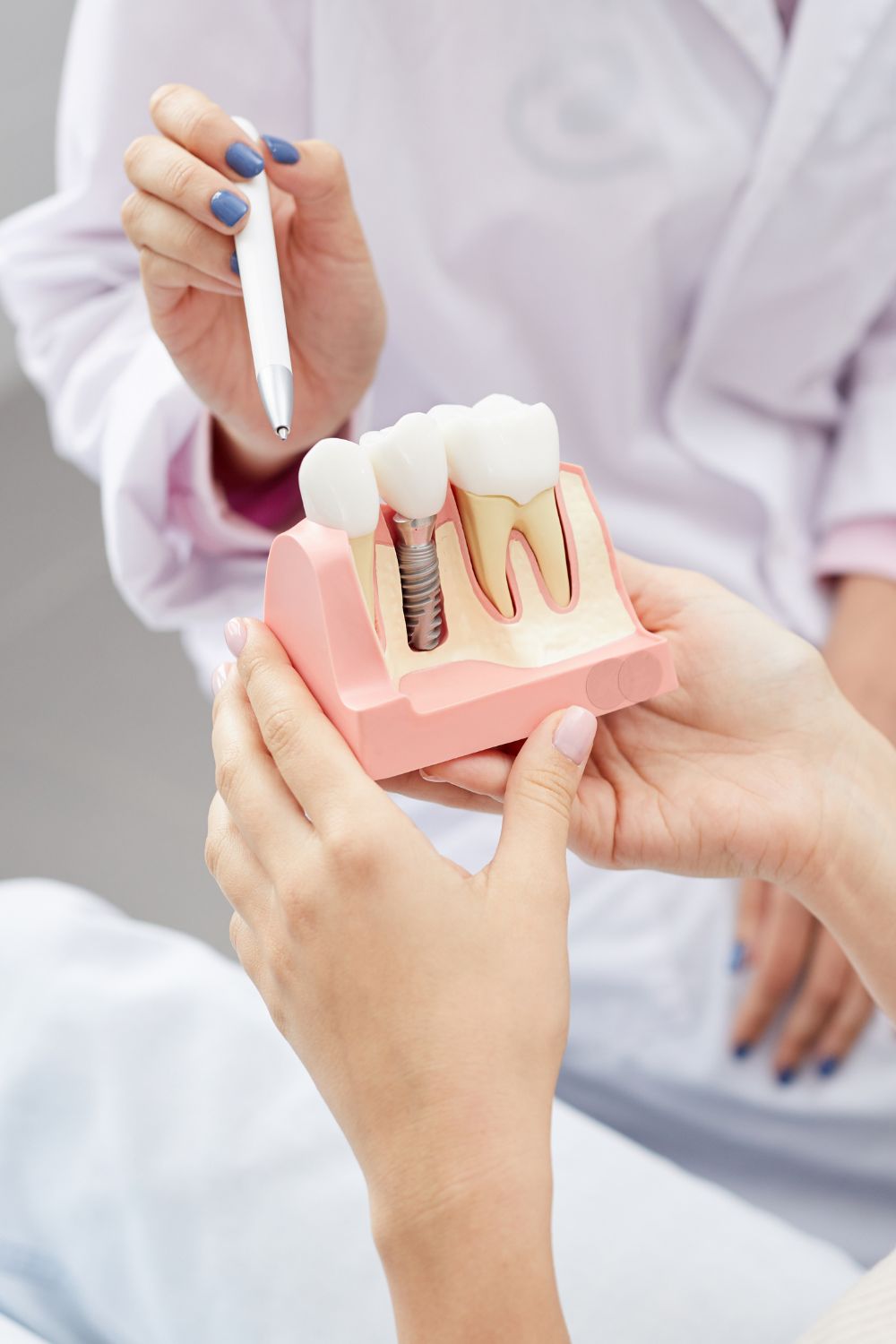 High-Quality Tooth Crown and Dental Bridge Treatment in Mysore